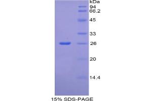 SDS-PAGE analysis of Rat CREB Binding Protein. (CBP Protein)