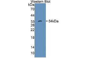 Figure. (PTPN22 Antikörper  (AA 1-256))