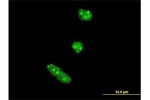 Immunofluorescence of monoclonal antibody to TWIST1 on HeLa cell. (TWIST1 Antikörper  (AA 100-202))