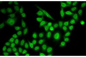 Immunofluorescence analysis of MCF-7 cells using RANGAP1 Polyclonal Antibody (RANGAP1 Antikörper)