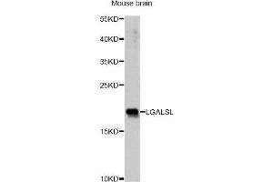 Western blot analysis of extracts of mouse brain, using LGALSL antibody. (GRP Antikörper)