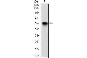 Western blot analysis using VIL1 mAb against human VIL1 (AA: 1-209) recombinant protein. (Villin 1 Antikörper  (AA 1-209))