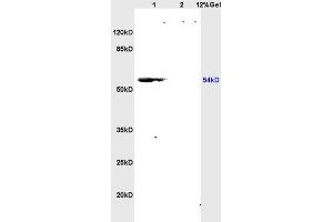 L1 rat brain lysates L2 rat kidney lysates probed with Anti CSIG Polyclonal Antibody, Unconjugated (ABIN728248) at 1:200 overnight at 4 °C. (RSL1D1 Antikörper  (AA 151-250))