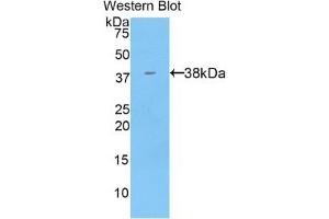 Detection of Recombinant KRT71, Mouse using Polyclonal Antibody to Keratin 71 (KRT71) (Keratin 71 Antikörper  (AA 132-440))