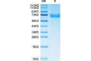 AXL Protein (AA 33-442) (His tag)