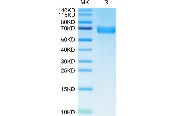 AXL Protein (AA 33-442) (His tag)