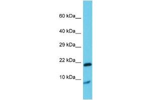 Host: Rabbit Target Name: Grem1 Sample Type: Rat Testis lysates Antibody Dilution: 1. (GREM1 Antikörper  (Middle Region))