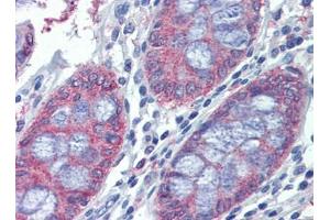 Human Colon: Formalin-Fixed, Paraffin-Embedded (FFPE) (METTL7B Antikörper  (C-Term))