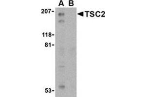 Western blot analysis of TSC2 in L1210 cell lysate with this product at 1 μg/ml in the (A) absence and (B) presence of blocking peptide. (Tuberin Antikörper  (C-Term))
