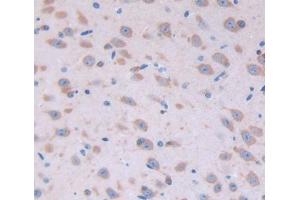 Used in DAB staining on fromalin fixed paraffin- embedded Kidney tissue (FGF22 Antikörper  (AA 26-162))