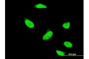Immunofluorescence (IF) image for anti-3'-phosphoadenosine 5'-phosphosulfate Synthase 1 (PAPSS1) (AA 144-252) antibody (ABIN563926)