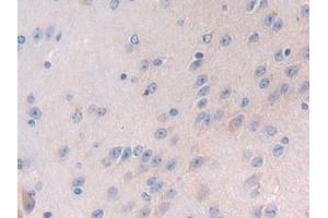 Immunohistochemistry (IHC) image for anti-Latent Transforming Growth Factor beta Binding Protein 1 (LTBP1) (AA 1415-1712) antibody (ABIN7440761)