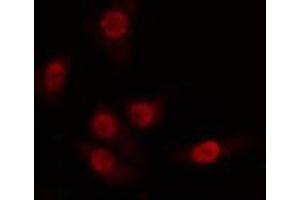 ABIN6274263 staining 293 cells by IF/ICC. (CDK8 Antikörper  (N-Term))