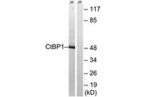 Western blot analysis of extracts from Jurkat cells, using CtBP1 (Ab-422) Antibody. (CTBP1 Antikörper  (AA 388-437))