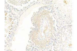 ABIN7094884 and ABIN7098937 at 1/100 staining Rat testis tissue by IHC-P. (TTC7A Antikörper  (Internal Region))