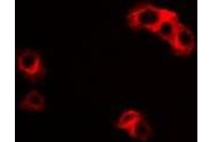 Immunofluorescent analysis of IL-23R staining in HepG2 cells.