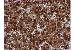 Image no. 14 for anti-Chromosome 1 Open Reading Frame 50 (C1ORF50) antibody (ABIN1497033)