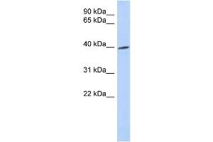 WB Suggested Anti-TRIB1 Antibody Titration: 0. (TRIB1 Antikörper  (Middle Region))
