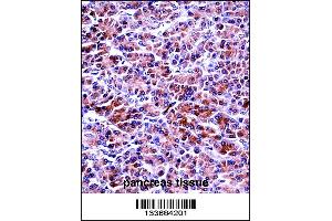 PRSS2 Antibody immunohistochemistry analysis in formalin fixed and paraffin embedded human pancreas tissue followed by peroxidase conjugation of the secondary antibody and DAB staining. (PRSS2 Antikörper  (AA 80-108))