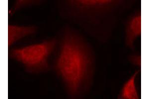 Immunofluorescence staining of methanol-fixed HeLa cells using MDM2 polyclonal antibody (Cat # PAB12253, Red). (MDM2 Antikörper  (Ser166))