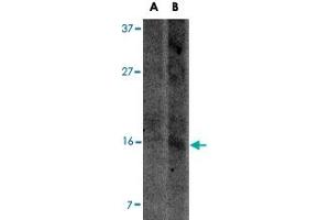 Western blot analysis of UCMA in SW1353 cell lysate with UCMA polyclonal antibody  at (A) 2. (UCMA Antikörper  (C-Term))