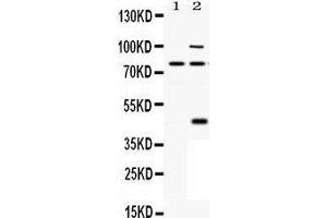 Observed bind size: 80KD, 45/80/100KD (PCSK6 Antikörper  (C-Term))