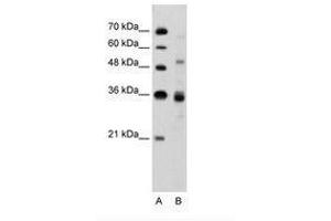 Image no. 1 for anti-CUGBP, Elav-Like Family Member 3 (CELF3) (N-Term) antibody (ABIN6736325) (CELF3 Antikörper  (N-Term))