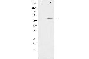 Caldesmon Antikörper  (pSer789)