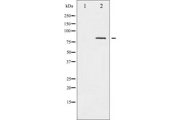 Caldesmon Antikörper  (pSer789)