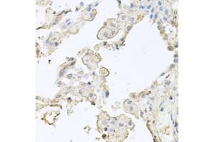 Immunohistochemistry of paraffin-embedded human lung using MMRN1 antibody. (Multimerin 1 Antikörper)
