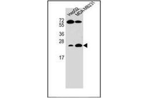 Western blot analysis of RhoJ Antibody  in HepG2,MDA-MB231 cell line lysates (35ug/lane). (RHOJ Antikörper  (Middle Region))