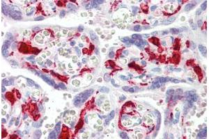 Human Placenta (formalin-fixed, paraffin-embedded) stained with F13A1 antibody ABIN461969 at 5 ug/ml followed by biotinylated secondary antibody, alkaline phosphatase-streptavidin and chromogen. (F13A1 Antikörper)