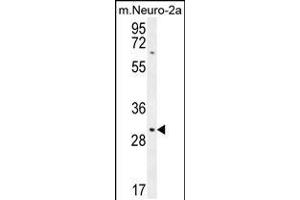 Western blot analysis in mouse Neuro-2a cell line lysates (35ug/lane). (TMEM65 Antikörper  (N-Term))