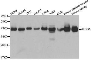 Western blot analysis of extracts of various cell lines, using ALDOA antibody. (ALDOA Antikörper  (AA 1-348))