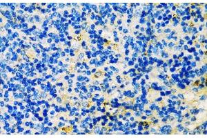 Immunohistochemistry of paraffin-embedded Mouse spleen using TIM-3/HAVCR2 Polyclonal Antibody at dilution of 1:200 (40x lens).