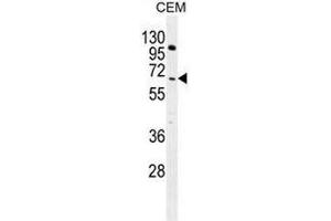 COL8A2 Antibody (C-term) western blot analysis in CEM cell line lysates (35µg/lane). (COL8a2 Antikörper  (C-Term, Chain alpha 2))