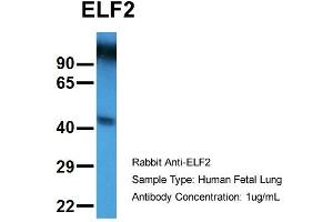 Host:  Rabbit  Target Name:  ELF2  Sample Type:  Human Fetal Lung  Antibody Dilution:  1. (ELF2 Antikörper  (N-Term))