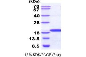 SDS-PAGE (SDS) image for NME/NM23 Nucleoside Diphosphate Kinase 3 (NME3) (AA 22-169) (Active) protein (His tag) (ABIN5854461) (NME3 Protein (AA 22-169) (His tag))