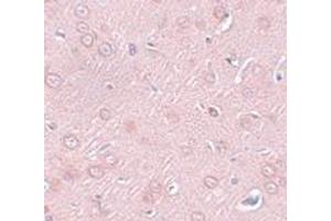 Immunohistochemistry (IHC) image for anti-Synaptogyrin 2 (SYNGR2) (N-Term) antibody (ABIN1031591) (SYNGR2 Antikörper  (N-Term))