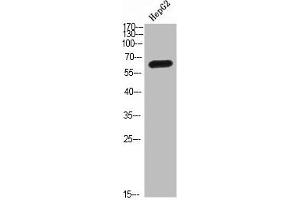 Western Blot analysis of HEPG2 cells using MIA2 Polyclonal Antibody diluted at 1:500. (MIA2 Antikörper  (AA 361-410))