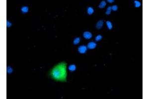 Anti-ANAPC2 mouse monoclonal antibody (ABIN2454940) immunofluorescent staining of COS7 cells transiently transfected by pCMV6-ENTRY ANAPC2 (RC207539). (ANAPC2 Antikörper)