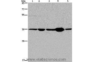 Western blot analysis of Human transitional cell carcinoma tissue, 293T and A172 cell, human testis tissue and Hela cell, using LZTFL1 Polyclonal Antibody at dilution of 1:550 (LZTFL1 Antikörper)