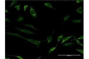 Immunofluorescence of monoclonal antibody to FH on HeLa cell. (FH Antikörper  (AA 33-510))