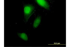 Immunofluorescence of monoclonal antibody to CRABP2 on HeLa cell. (CRABP2 Antikörper  (AA 1-138))