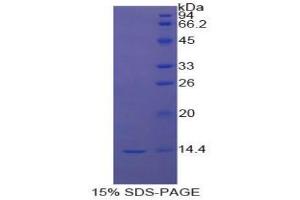 SDS-PAGE (SDS) image for Signal Transducer and Activator of Transcription 3 (Acute-Phase Response Factor) (STAT3) protein (ABIN3011661)
