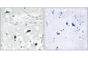 Immunohistochemistry analysis of paraffin-embedded human brain tissue, using Caspase 3 (Cleaved-Asp175) Antibody.