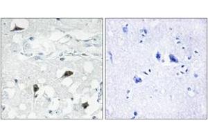 Immunohistochemistry analysis of paraffin-embedded human brain tissue, using Caspase 3 (Cleaved-Asp175) Antibody. (Caspase 3 Antikörper  (Cleaved-Asp175))
