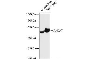 Western blot analysis of extracts of various cell lines using AADAT Polyclonal Antibody at dilution of 1:3000. (AADAT Antikörper)