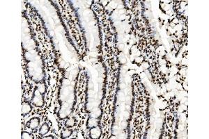 IHC analysis of KAP1/TRIM28 using anti-KAP1/TRIM28 antibody (ABIN7602310).