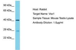 Image no. 1 for anti-Visual System Homeobox 1 (VSX1) (AA 282-331) antibody (ABIN6750281) (VSX1 Antikörper  (AA 282-331))